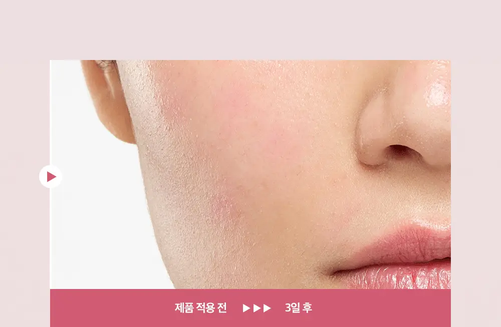 [7월올영픽/손상장벽리페어] 피지오겔 레드수딩 AI 리페어 크림 100m 기획(+30ml+마스크 2매) 상세페이지 15